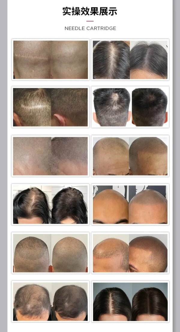 Black Scalp Micropigmentation Ink 15ml SMP pigment For Hair Follicles - Image 2