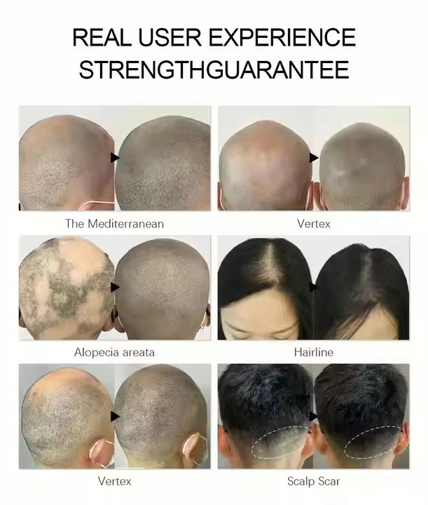 Before & After SMP Results Using BangyaProfessional Fade-Resistant Ink